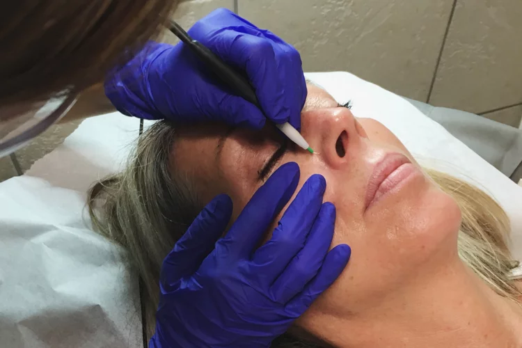 Traitement de Thermocoagulation