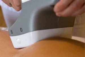 VelaShape II