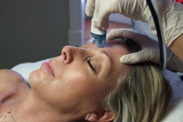 Exfoliation du visage par Microdermabrasion - Soin Excellence